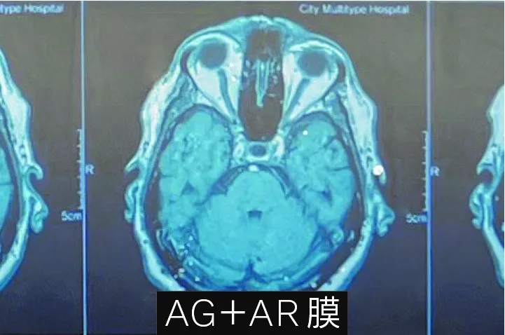 AG＋AR膜を形成したディスプレイ