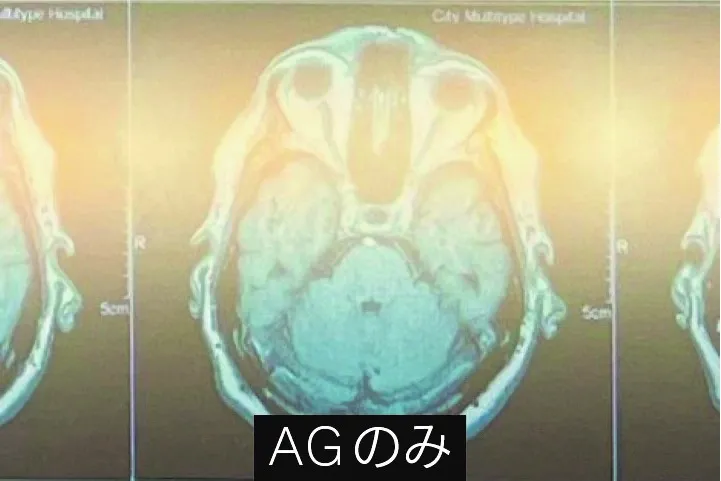 AGのみ膜を形成したディスプレイ